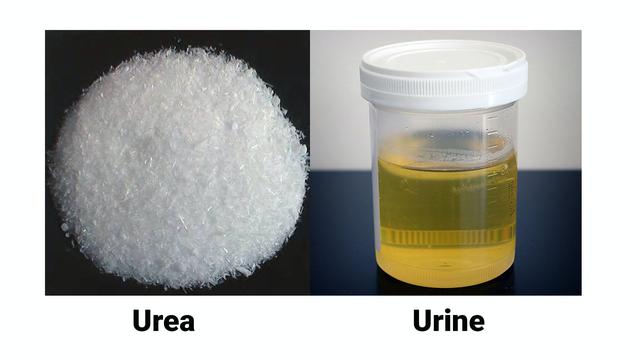 acne urine urea